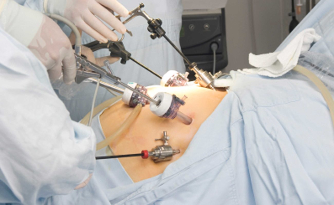 laparoscopic device development